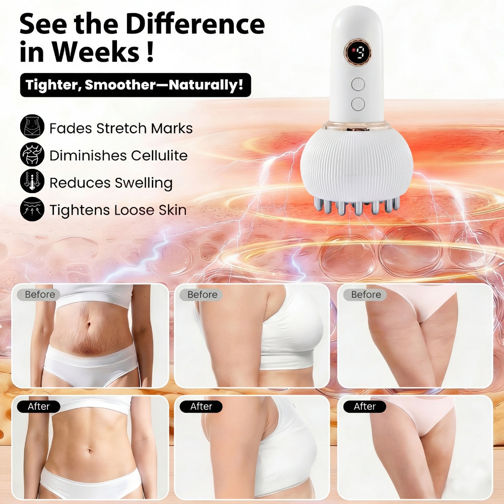 Cellulite & Lymphatic Drainage Massager