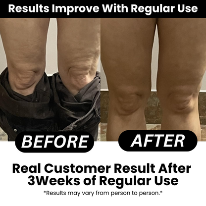 Talnerro™ - Anti-cellulite Massage Oil (240 ml)